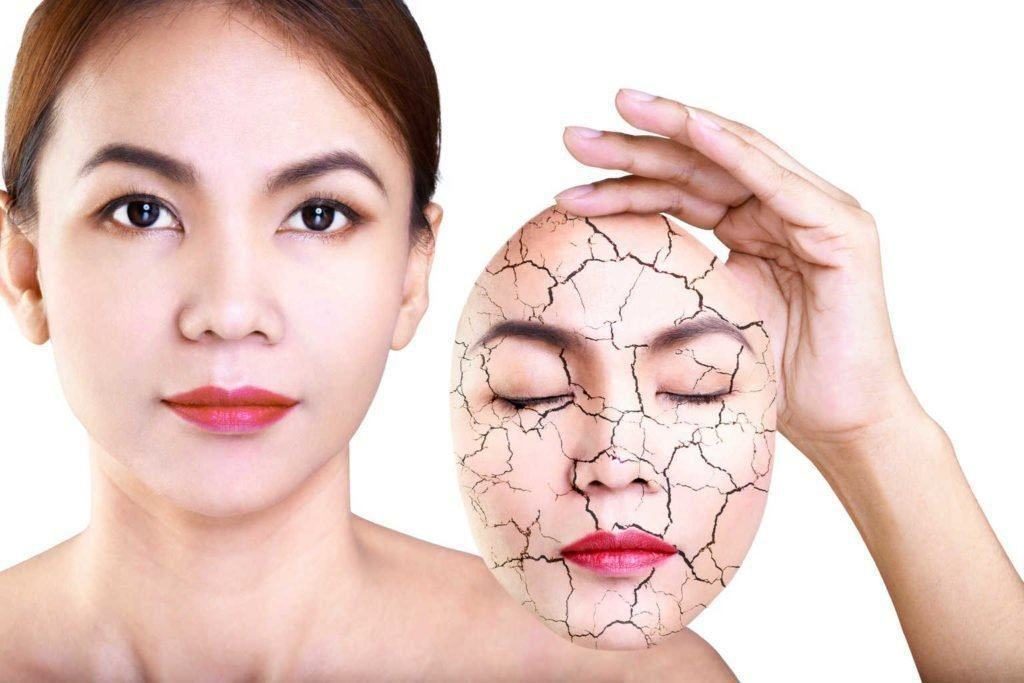 Atasi-Kulit-Kering-Dengan-Minyak-Esensial